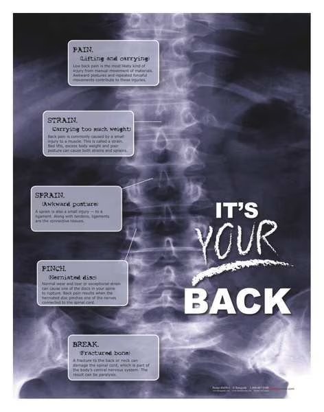Safety Poster, X-Ray Its Your Back, ENG, SAFETYPOSTER.COM, Mfr# P4450